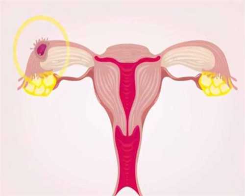 国内第三代试管婴儿的费用究竟如何？附高效省钱助孕方案